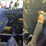 El usuario, Richardo1799, respondió a una publicación del América en donde puso unas fotos donde se observan las heridas que tuvo su padre.