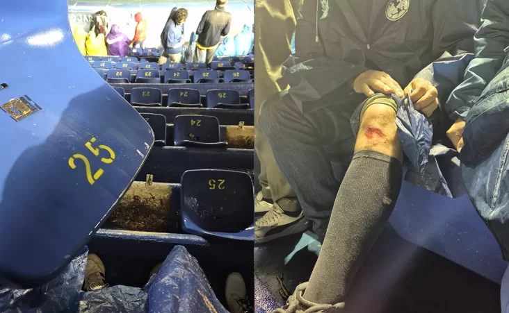 El usuario, Richardo1799, respondió a una publicación del América en donde puso unas fotos donde se observan las heridas que tuvo su padre.