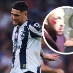 Rayados confirmó el parte médico mediante un comunicado en el que detalla que Ocampos será operado.