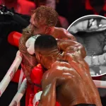 A través de redes sociales, Jake Paul compartió una radiografía en la que se aprecian dos fisuras en la mandíbula.