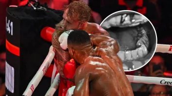 A través de redes sociales, Jake Paul compartió una radiografía en la que se aprecian dos fisuras en la mandíbula.