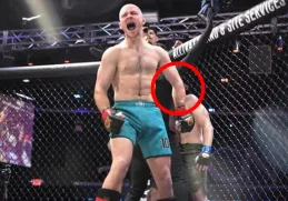 Durante el intercambio de golpes, Zima sufrió una fractura en el brazo izquierdo sin darse cuenta de inmediato.